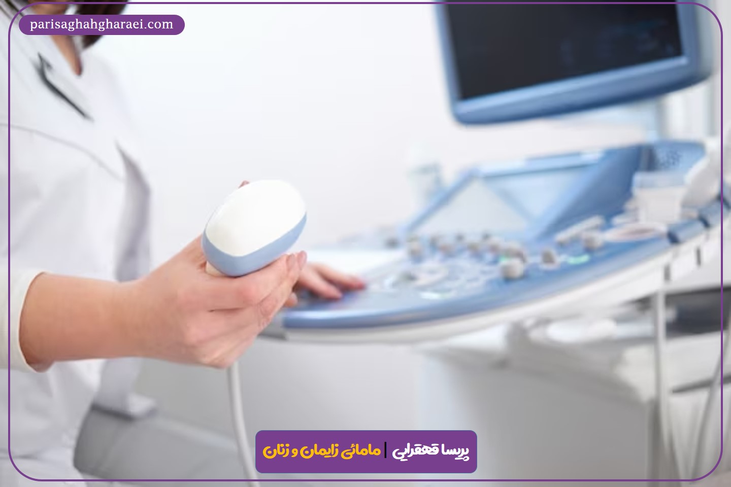 هزینه تست پاپ اسمیر چقدر است