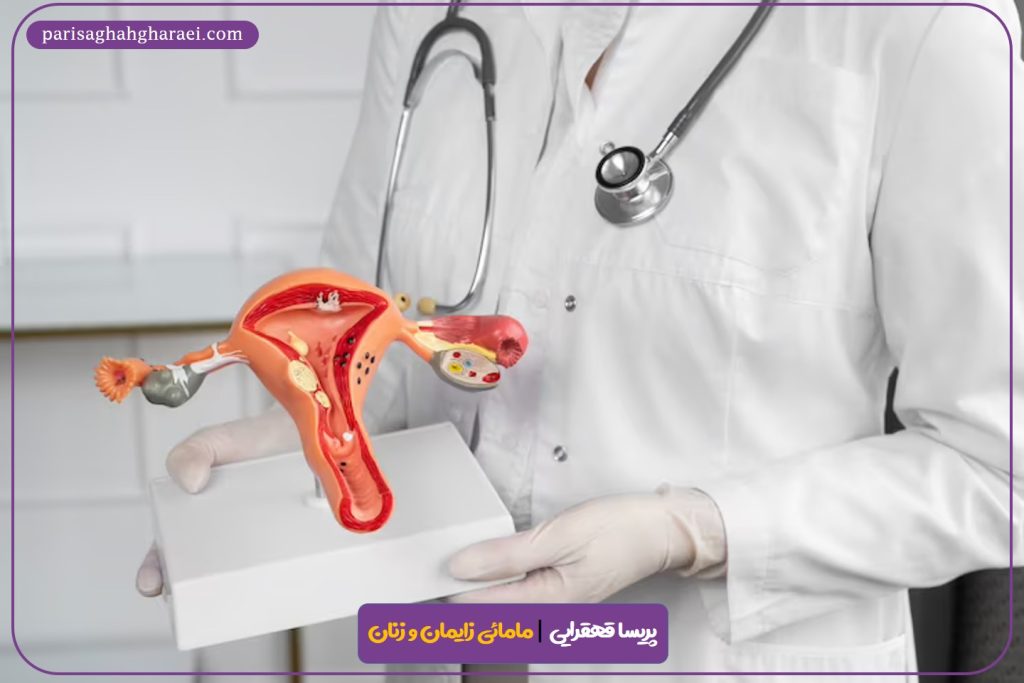 کیست تخمدان